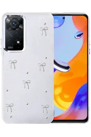 Xiaomi Redmi Note 11 Pro 4G Kılıf Sima Tech Simli Desenli Şeffaf Kapi Kapak
